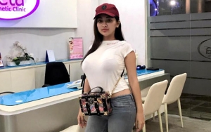  Cupi Cupita Merasa Cantik Alami Bukan Cuma Modal Dada Tumpah, Netter Emosi Kompak Tak Setuju