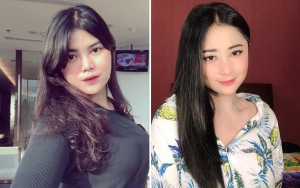 Rosa Meldianti Diejek Aneh Saat Pamer Lesung Pipi Baru, Minta Stop Pencitraan Sindir Dewi Persik?