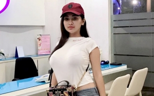 Cakar Teman Sampai Berdarah, Cupi Cupita Mewek Dibully Artis Jual Dada dan Cari Sensasi