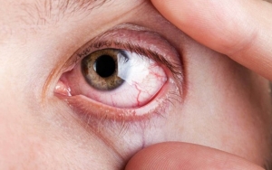 Penggunaan Gadget yang Berlebihan Berbahaya Untuk Kesehatan Mata