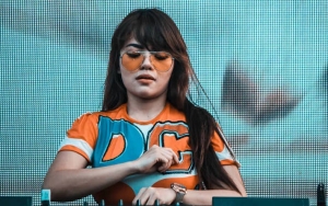  Beredar Foto Lawas Dinar Candy Yang Beda Banget, Bentuk Jidat dan Hidung Jadi Sorotan
