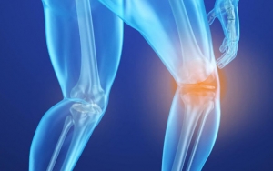 Malas Gerak Rupanya Juga Bisa Memicu Terjadinya Osteoporosis atau Pengeroposan Tulang