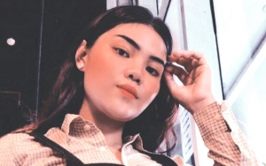 Meldi 'Bersisik' Digoda Kalah Cantik dari Millen-Lucinta, Wajah Mulus Efek Kamera Jahat?