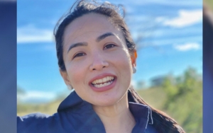 Feni Rose Cantik Alami Bak Bidadari Khayangan Sambil Pamer Kaki Mulus, Rahasia Bebas Oplas Terkuak