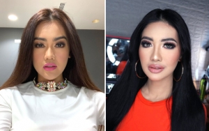 Adik Mendiang Julia Perez Curhat Hingga Umbar Foto Tangan Penuh Luka, Ada Apa?