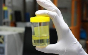 Deteksi Penggunaan Narkoba, BNN Sarankan Universitas Lakukan Tes Urine ke Mahasiswa