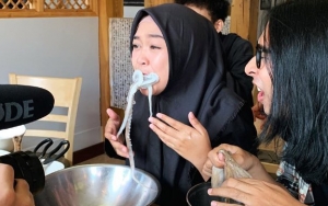 Heboh Ria Ricis Dituding Makan Gurita Hidup, Ternyata Seperti Ini Bahayanya