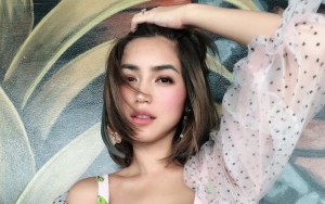 Jessica Iskandar Tuai Kritik Pamer 'Punggung Bolong' Saat Kabarkan Ruam Merah Wajah Mulai Sembuh