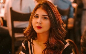 Kesha Ratuliu Bikin Heboh Gara-Gara Titik Merah di Dada, Bekas Apa?