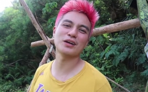 Baim Wong Dikira Cat Rambut Jadi Hitam Saat Sampai di Indonesia Hingga Ramai Diprotes