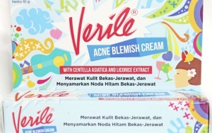 Verile Acne Blemish Cream Dapat Menghilangkan Bekas Jerawat dan Melembutkan Kulit Kasar