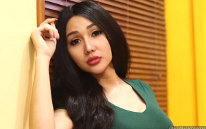 Tak Gentar Usai Ketahuan Botak, Lucinta Luna Unggah Foto Seksi Dipuji Bak Boneka