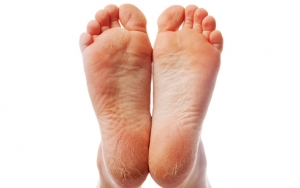 Ada Bagian Kulit Yang Kasar? Tak Perlu Khawatir Body Lotion Bisa Melembutkannya