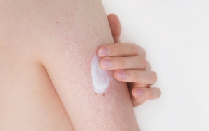 Body Lotion Juga Bisa Menjadi Pelindung Kulit Dari Iritasi