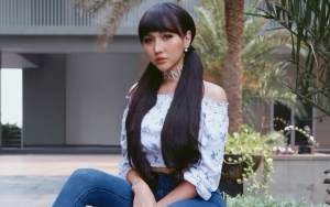  Lucinta Luna Bantah Kepala Botak Tapi 'Botum', Ungkap Biaya Perawatan Rambut Hingga Rp50 Juta