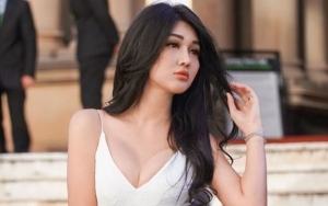 Lucinta Luna Minta Rosa Meldianti Diet dan Operasi Plastik Apabila Ingin Daftar Puteri Indonesia