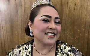 Psikiater Beberkan Nunung Terkena Depresi dan Diabetes