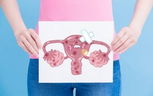 Waspadai, Diet Yoyo Bisa Meningkatkan Resiko Kanker Endometriosis
