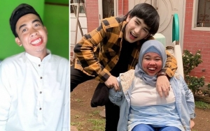  Pernah Jadi Korban, Mimi Peri Kembali Sentil Pacar Rahmawati Kekeyi 'Maniak' Pansos