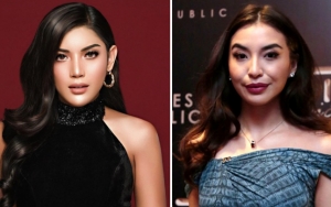  Netter Sesali Wajah Tampan Millendaru Sebelum Dipermak, Sekarang Makin Mirip Manohara
