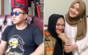  Pakar Ekspresi Analisa Hubungan Teddy dan Putri Delina, Hasilnya Tak Sesuai Pemberitaan