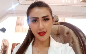 Rey Utami Alami Bengkak Hingga Pembuluh Darah Pecah di Bagian Mata Kiri Gara-Gara Ini
