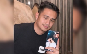 Ajun Perwira Tetap Pede Meski Bibir Bengkak Karena Alergi Makanan Mahal