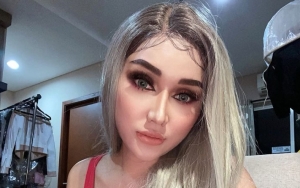 Ambisius Ingin Mirip Kylie Jenner, Lucinta Luna Ubah Penampilan Tuai Respon Tak Terduga