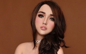  Netizen Sesalkan Wajah Lucinta Luna Makin Aneh Sejak Doyan Permak, Tanda Tak Percaya Diri?