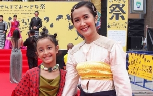 Widi Mulia Akui Tak Lagi Dituding Permak Hidung Berkat Anak Kedua, Kok Bisa?