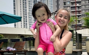 Joanna Alexandra Bagikan Potret Anak Bungsu yang Idap Penyakit Langka, Banjir Dukungan dan Doa
