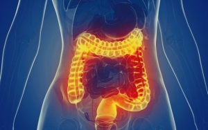 Inflammatory Bowel Disease (IBD) Atau Radang Usus Juga Bisa Disebabkan Autoimun