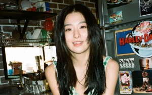 Seulgi Red Velvet Pamer Wajah Berbintik Tuai Komentar Tak Suka