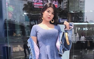 Rosa Meldianti Sombongkan Kecantikan, Wajah 'Merah Mendidih' Dicibir Udang Rebus