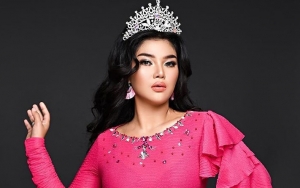 Rosa Meldianti Pamer Paha Mulus Justru Dikira Tak Pakai Celana Dalam