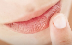 Gunakan Lip Butter Atau Oleskan Madu Sebelum Tidur