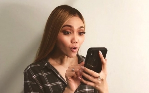 Dituding Umbar Aurat, Rina Nose Beri Jawaban Kocak Tuai Pembelaan