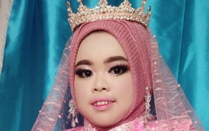 Rahmawati Kekeyi Mendadak Cantik Langsing Bak Bidadari Surga, Kok Bisa?