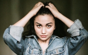  Ariel Tatum Ungkap Alami Gejala Kebotakan, Lakukan Ini Agar Tetap Percaya Diri