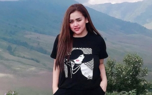 Clara Gopa Tunjukkan Bekas Sayatan Di Tangan Akibat Percobaan Bunuh Diri