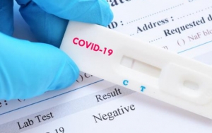 PCR Mahal, IDI Sebut Rapid Test Sudah Cukup Sebagai Syarat Calon Penumpang Pesawat