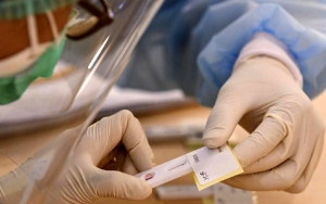 Akurasi Cukup Rendah, Gugus Tugas Jelaskan Kenapa Rapid Test Corona Tetap Digelar