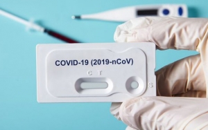 Dinilai Buang-Buang Biaya dan Tak Bermanfaat, Jokowi Diminta Hentikan Rapid Test Corona