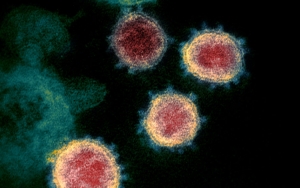 CDC AS Tambahkan 3 Gejala Terinfeksi Virus Corona, Ini Daftar Lengkapnya