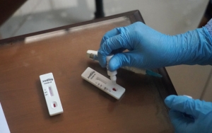 Langkah Kemenkes Batasi Rapid Test Rp 150 Ribu Dinilai Belum Bisa Jadi Solusi