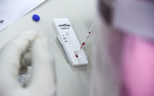 Harga Rapid Test Dibatasi Rp 150 Ribu, Pemerintah Akan Sanksi RS 'Nakal'
