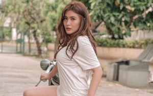 Serem Banget, Angela Lee Alami Iritasi Hingga Bengkak Akibat Kucek-Kucek Mata