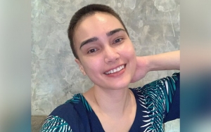 Feby Febiola Akhirnya Akui Idap Kanker Ovarium, Ungkap Kondisi Usai Pertama Kemoterapi