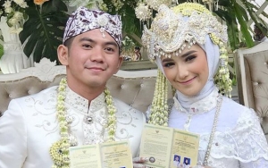 Cantik Polos, Nadya Istri Rizki DA Dibully Kuku Berkutek Hingga Kedok Sok Alim Demi Endorse