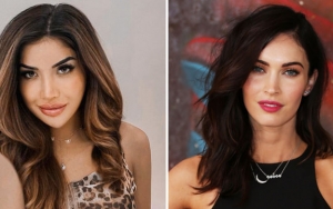 Wajah Millendaru Usai Filler Bibir Disandingkan Dengan Megan Fox, Mirip?
